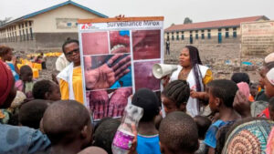 África, OMS, viruela