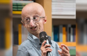 progeria, Sammy Basso