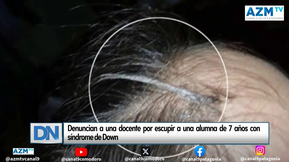 Denuncian a una docente por escupir a una alumna de 7 años con síndrome de Down
